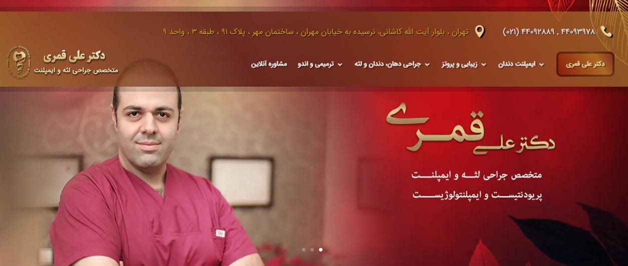 مرکز ایمپلنت در تهران