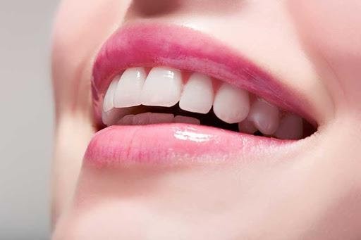 زیبایی ایمپلنت دندان .