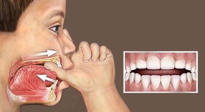 تأثیر پستانک و مکیدن انگشت بر دندان کودک 
