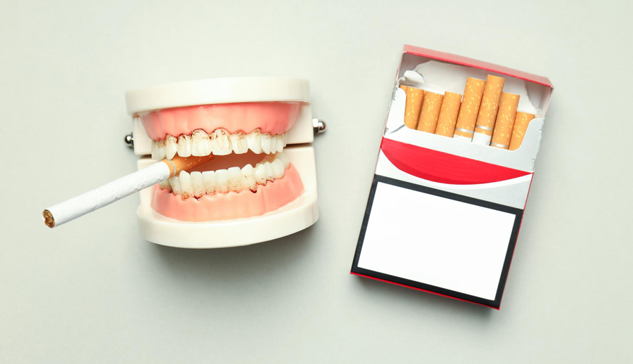 ایمپلنت و سیگار