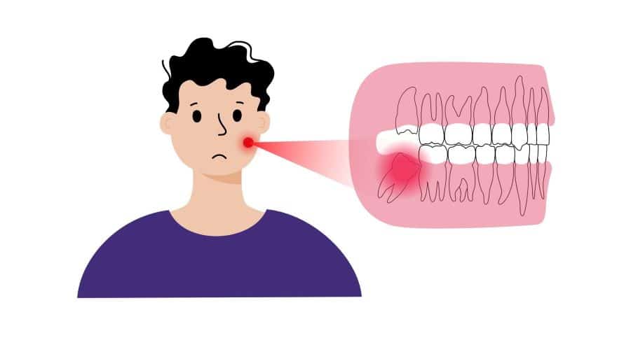 دندان عقل کجاست ؟