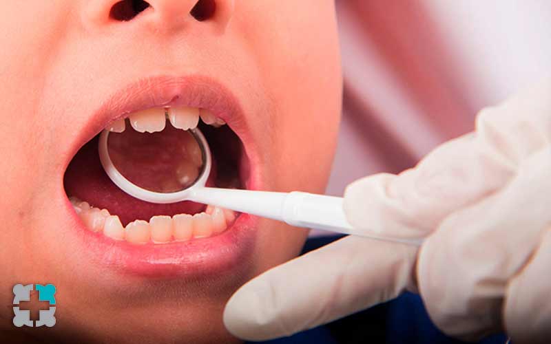 بررسی دندان اطفال