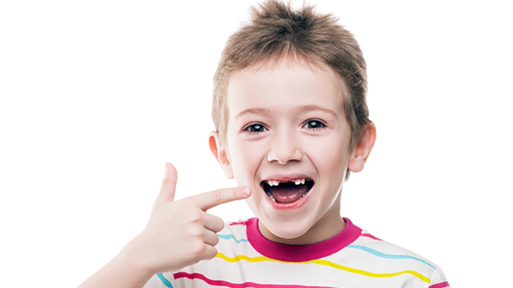 عکس ریشه دندان شیری