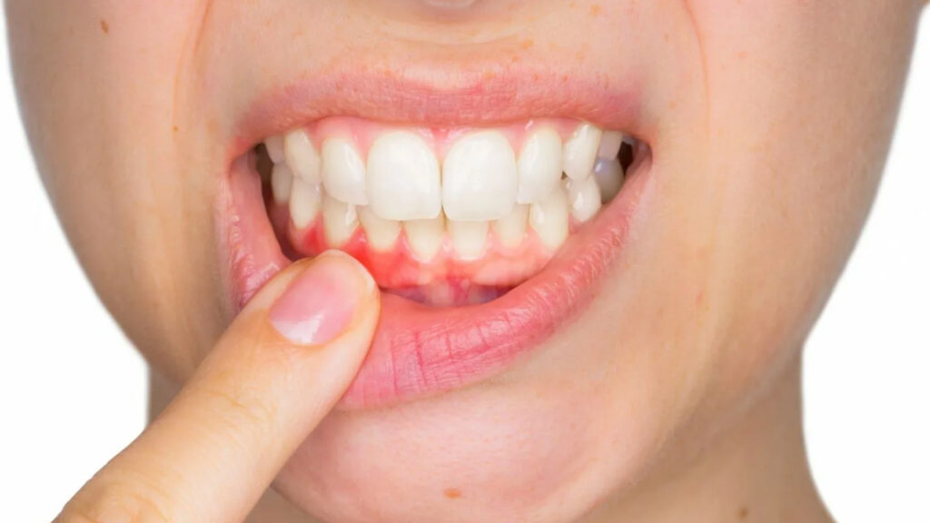 دلایل لثه درد