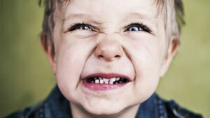 دندان قروچه کودکان