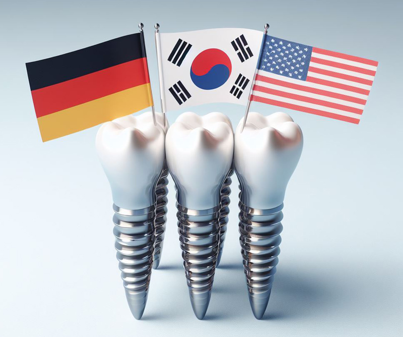 بهترین ایمپلنت ساخت کدام کشور است