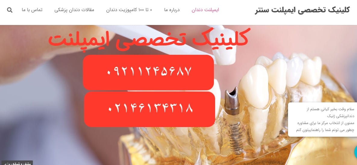 ایمپلنت سنتر