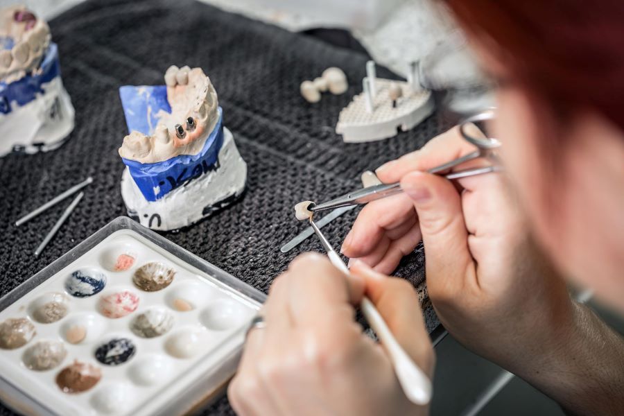 مراحل قالب گیری ایمپلنت