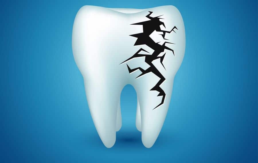علت ترک روی دندان