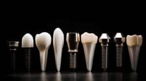 انواع ایمپلنت